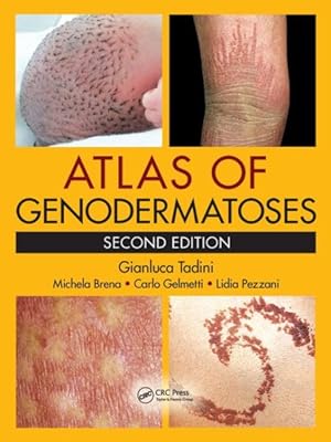 Immagine del venditore per Atlas of Genodermatoses venduto da GreatBookPrices