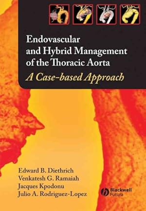 Imagen del vendedor de Endovascular and Hybrid Management of the Thoracic Aorta : A Case-based Approach a la venta por GreatBookPrices