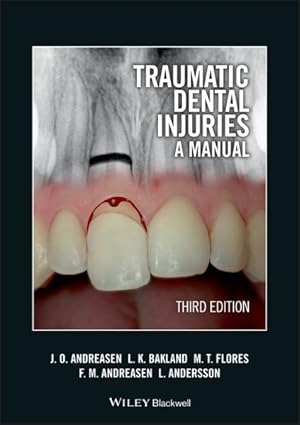 Bild des Verkufers fr Traumatic Dental Injuries : A Manual zum Verkauf von GreatBookPrices
