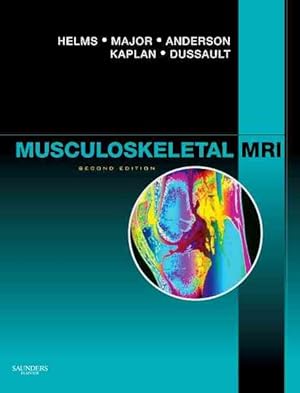 Seller image for Musculoskeletal MRI for sale by GreatBookPrices