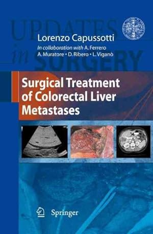 Immagine del venditore per Surgical Treatment of Colorectal Liver Metastases venduto da GreatBookPrices