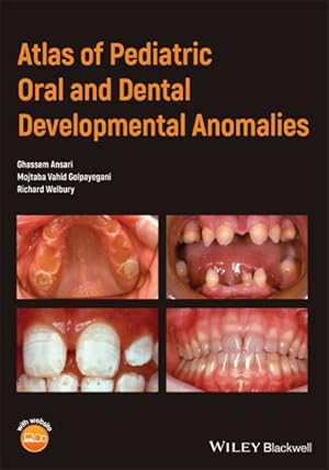 Seller image for Atlas of Pediatric Oral and Dental Developmental Anomalies for sale by GreatBookPrices