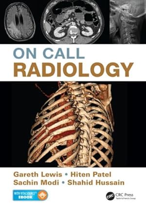Seller image for On Call Radiology for sale by GreatBookPrices