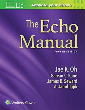 Seller image for Echo Manual for sale by GreatBookPrices