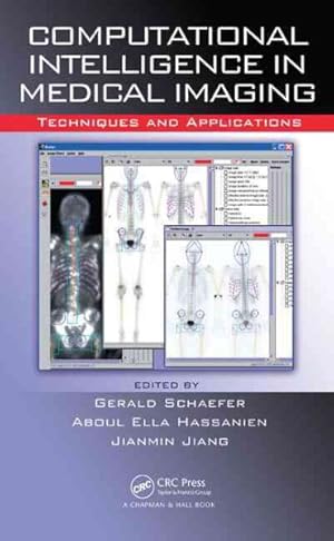 Image du vendeur pour Computational Intelligence in Medical Imaging : Techniques and Applications mis en vente par GreatBookPrices