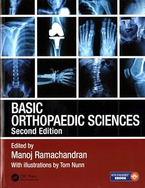 Imagen del vendedor de Basic Orthopaedic Sciences a la venta por GreatBookPrices