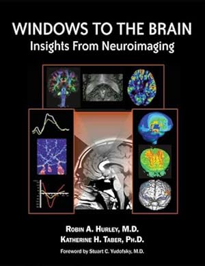 Seller image for Windows to the Brain : Insights From Neuroimaging for sale by GreatBookPrices