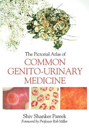 Imagen del vendedor de Pictorial Atlas of Common Genito-Urinary Medicine a la venta por GreatBookPrices