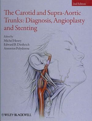 Bild des Verkufers fr Carotid and Supra-Aortic Trunks : Diagnosis, Angioplasty and Stenting zum Verkauf von GreatBookPrices