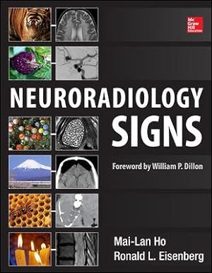 Imagen del vendedor de Neuroradiology Signs a la venta por GreatBookPrices