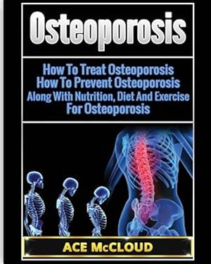 Immagine del venditore per Osteoporosis : How to Treat Osteoporosis: How to Prevent Osteoporosis: Along With Nutrition, Diet and Exercise for Osteoporosis venduto da GreatBookPrices