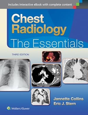 Seller image for Chest Radiology : The Essentials for sale by GreatBookPrices