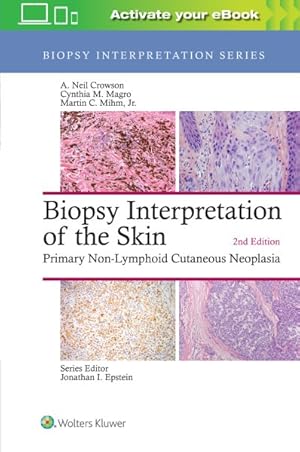 Bild des Verkufers fr Biopsy Interpretation of the Skin : Primary Non-lymphoid Cutaneous Neoplasia zum Verkauf von GreatBookPrices