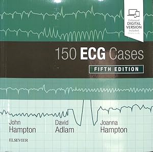 Seller image for 150 ECG Cases for sale by GreatBookPrices