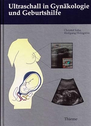 Ultraschall in Gynäkologie und Geburtshilfe.