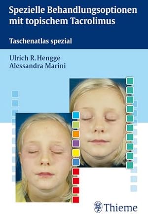 Bild des Verkufers fr Spezielle Behandlungsoptionen mit topischem Tacrolimus. Taschenatlas spezial : Taschenatlas spezial zum Verkauf von AHA-BUCH