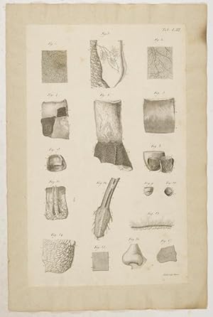 Bild des Verkufers fr Anatomische Tafeln: Die Arterien der Haut; Die Venen der Haut; Die Saugadern der Haut; Ein Teil der Lederhaut der Brust; . nach W. Albinius, Hunter, Loder, Ruysch. zum Verkauf von Antiq. F.-D. Shn - Medicusbooks.Com