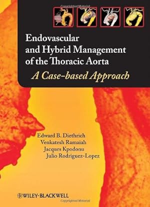 Seller image for Endovascular and Hybrid Management of the Thoracic Aorta: A Case-based Approach by Diethrich, Edward B., Ramaiah, Venkatesh, Kpodonu, Jacques, Rodriguez-Lopez, Julio A. [Hardcover ] for sale by booksXpress