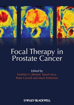 Seller image for Focal Therapy in Prostate Cancer [Hardcover ] for sale by booksXpress