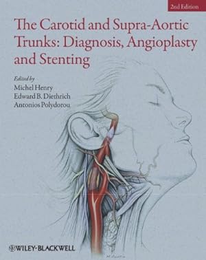 Seller image for The Carotid and Supra-Aortic Trunks: Diagnosis, Angioplasty and Stenting by Henry, Michel, Diethrich, Edward B., Polydorou, Antonios [Hardcover ] for sale by booksXpress