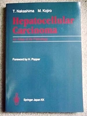 Hepatocellular Carcinoma: An Atlas Of Its Pathology