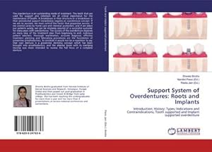 Seller image for Support System of Overdentures: Roots and Implants : Introduction; History; Types; Indications and Contraindications; Tooth supported and Implant supported overdenture for sale by AHA-BUCH GmbH