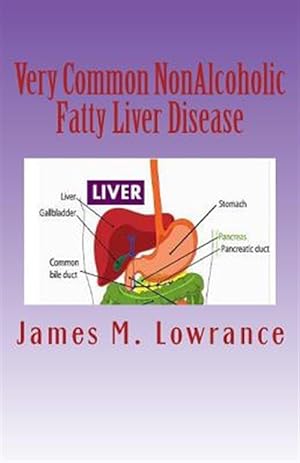 Imagen del vendedor de Very Common Non-Alcoholic Fatty Liver Disease : How to Know If You Have Hepatic Steatosis a la venta por GreatBookPrices