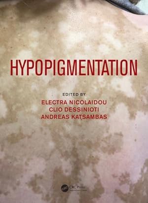 Imagen del vendedor de Hypopigmentation a la venta por GreatBookPrices