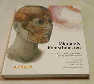 Migräne & Kopfschmerzen. Ein Fachbuch für Hausärzte, Fachärzte, Therapeuten und Betroffene. Autor...