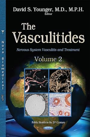 Seller image for Vasculitidies : Nervous System Vasculitis and Treatment for sale by GreatBookPrices