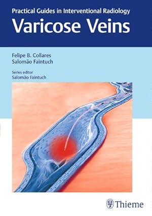 Bild des Verkufers fr Varicose Veins: Practical Guides in Interventional Radiology : Practical Guides in Interventional Radiology zum Verkauf von AHA-BUCH