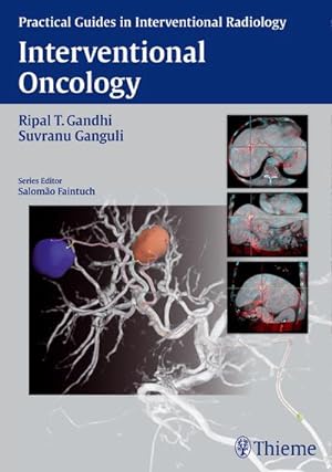 Bild des Verkufers fr Interventional Oncology (Practical Guides in Interventional Radiology) zum Verkauf von AHA-BUCH
