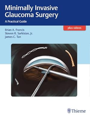 Bild des Verkufers fr Minimally Invasive Glaucoma Surgery: A Practical Guide : A Practical Guide zum Verkauf von AHA-BUCH
