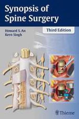 Bild des Verkufers fr Synopsis of Spine Surgery zum Verkauf von AHA-BUCH