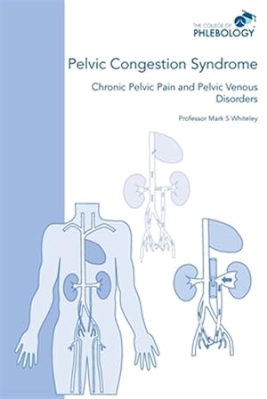 Bild des Verkufers fr Pelvic Congestion Syndrome - Chronic Pelvic Pain And Pelvic Venous Disorders zum Verkauf von GreatBookPrices
