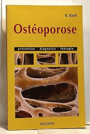 Bild des Verkufers fr Ostoporose : Prvention diagnostic thrapie zum Verkauf von crealivres