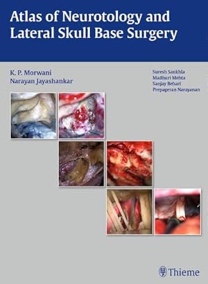 Bild des Verkufers fr Atlas of Neurotology and Lateral Skull Base Surgery zum Verkauf von AHA-BUCH GmbH
