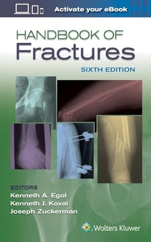 Image du vendeur pour Handbook of Fractures mis en vente par GreatBookPrices