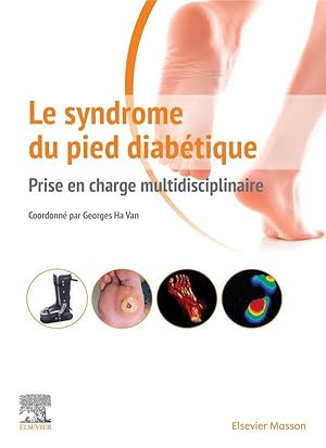 le syndrome du pied diabétique ; prise en charge multidisciplinaire
