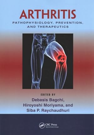Imagen del vendedor de Arthritis : Pathophysiology, Prevention, and Therapeutics a la venta por GreatBookPrices