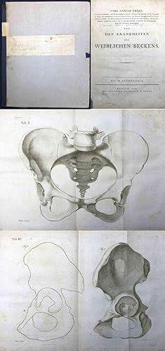 Bild des Verkufers fr Von den Krankheiten des weiblichen Beckens. Erster Theil: Von den Beinbrchen der Beckenknochen und den Krankheiten ihrer Verbindungen (alles Ercshienene) zum Verkauf von Graphem. Kunst- und Buchantiquariat