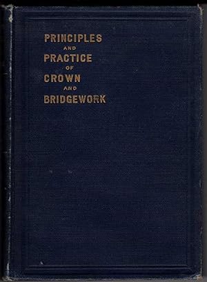 Principles and Practice of Crown and Bridgework