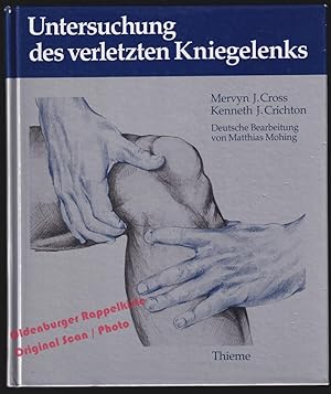 Untersuchung des verletzten Kniegelenks - Cross, Mervyn J./ Crichton, Kenneth J.