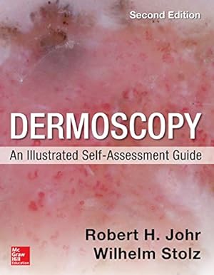 Imagen del vendedor de Dermoscopy: An Illustrated Self-Assessment Guide, 2/e by Johr, Robert, Stolz, Wilhelm [Paperback ] a la venta por booksXpress