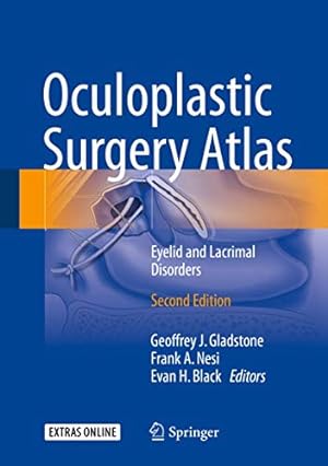atlas lacrimal surgery - AbeBooks