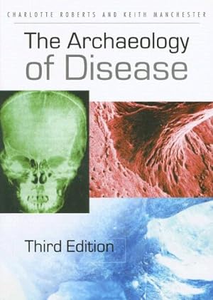 Imagen del vendedor de The Archaeology of Disease by Roberts, Charlotte, Manchester, Keith [Paperback ] a la venta por booksXpress