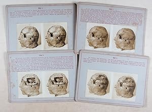 Stereoskopische Bilder zur Gehirn-Schädel-Topographie (Stereoscopic Images for Brain-Skull-Topogr...