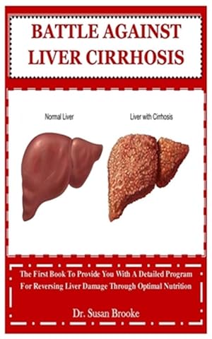 Bild des Verkufers fr Battle Against Liver Cirrhosis: The First Book To Provide You With A Detailed Program For Reversing Liver Damage Through Optimal Nutrition zum Verkauf von GreatBookPrices