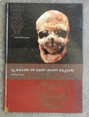 Seller image for La maladie de Paget avant Sir James. for sale by Librairie les mains dans les poches