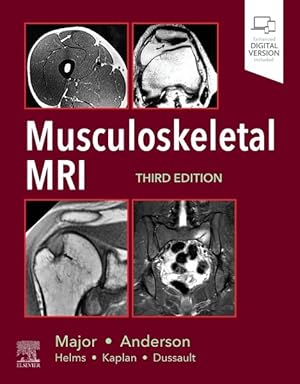 Imagen del vendedor de Musculoskeletal MRI a la venta por GreatBookPrices